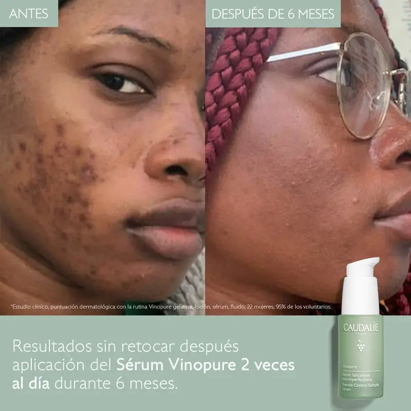 Caudalíe Vinopure Sérum Salicílico Anti-Imperfecciones - 30 ml