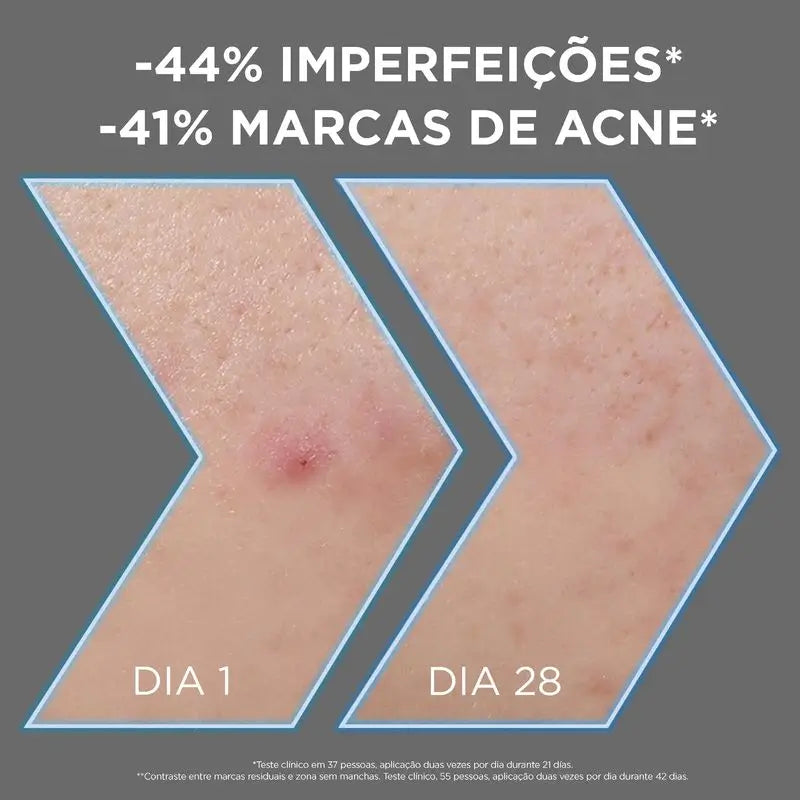 Garnier Sérum Anti-Perfeições com 4% de Niacinamida, Aha e Bha, 30Ml