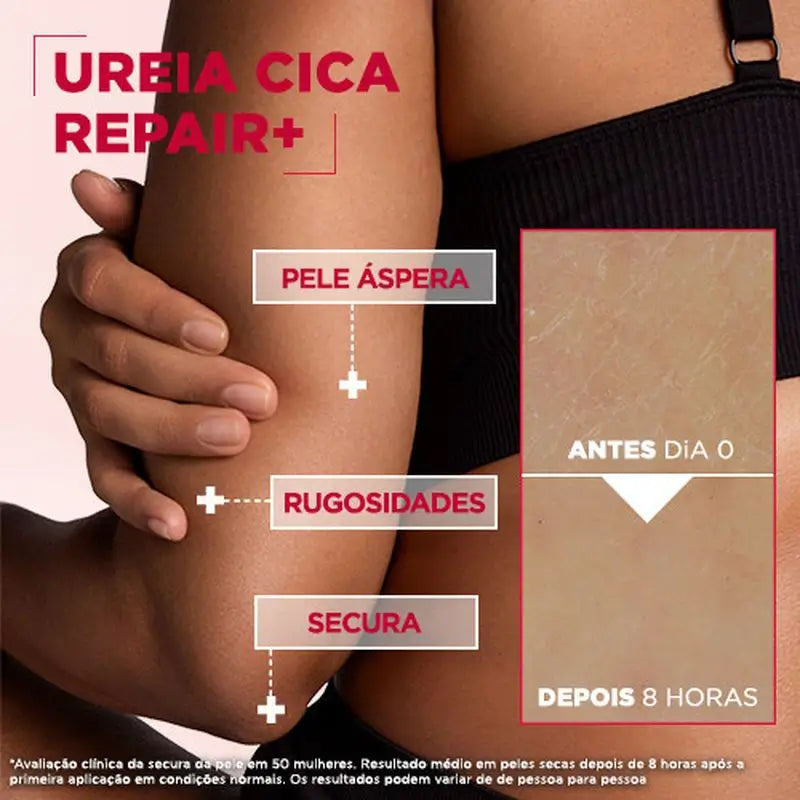 Autres Public Mixa Body Care Mixa Urea Cica Repair+ Replenishing Balm for Dry, Rough and Irregular Skin 400Ml